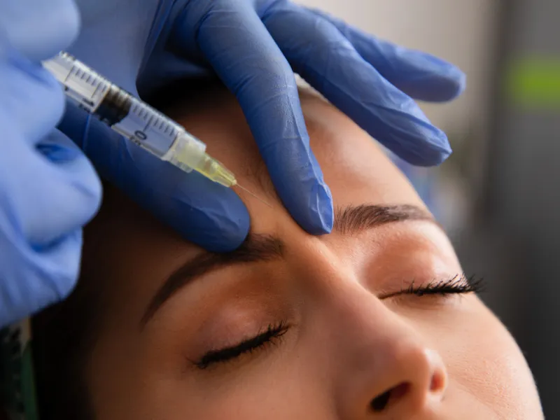 botox procedure