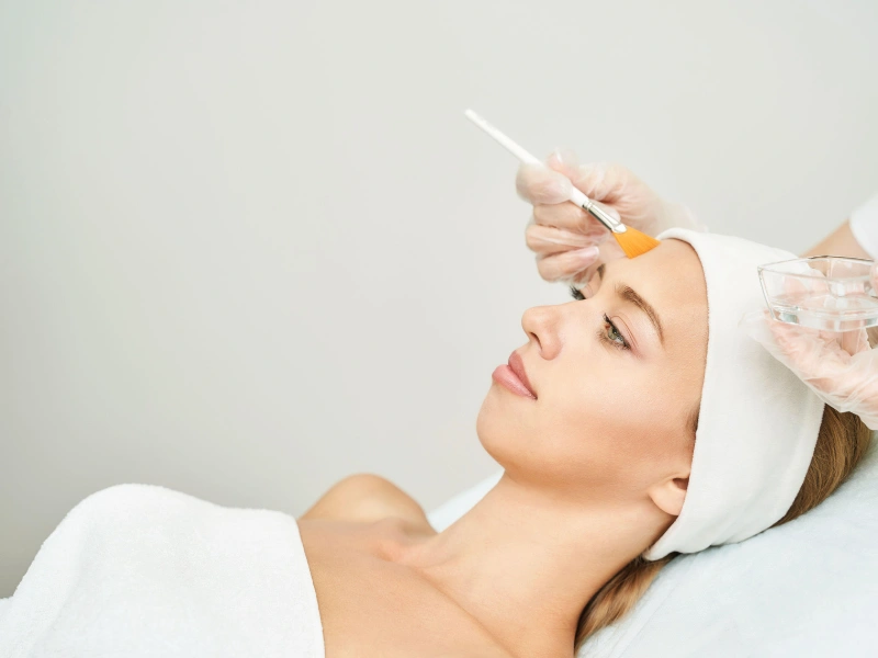 ideal candidates for chemical peel treatment