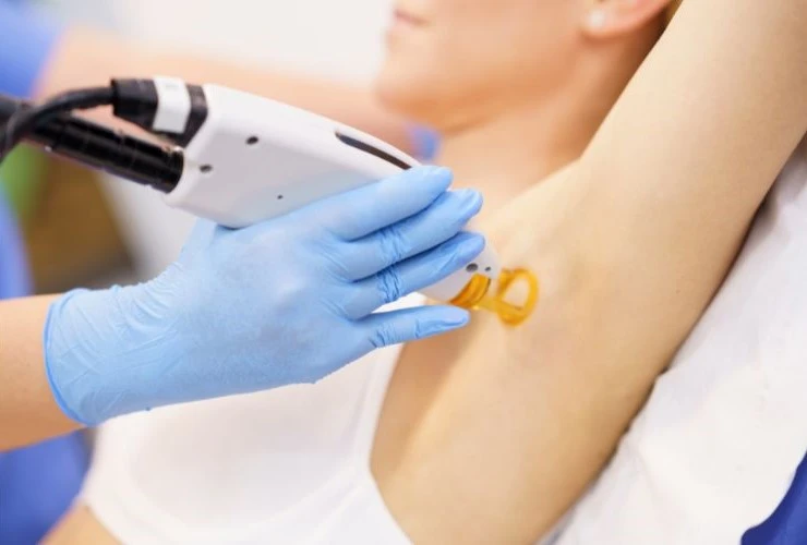 laser hair removal before after