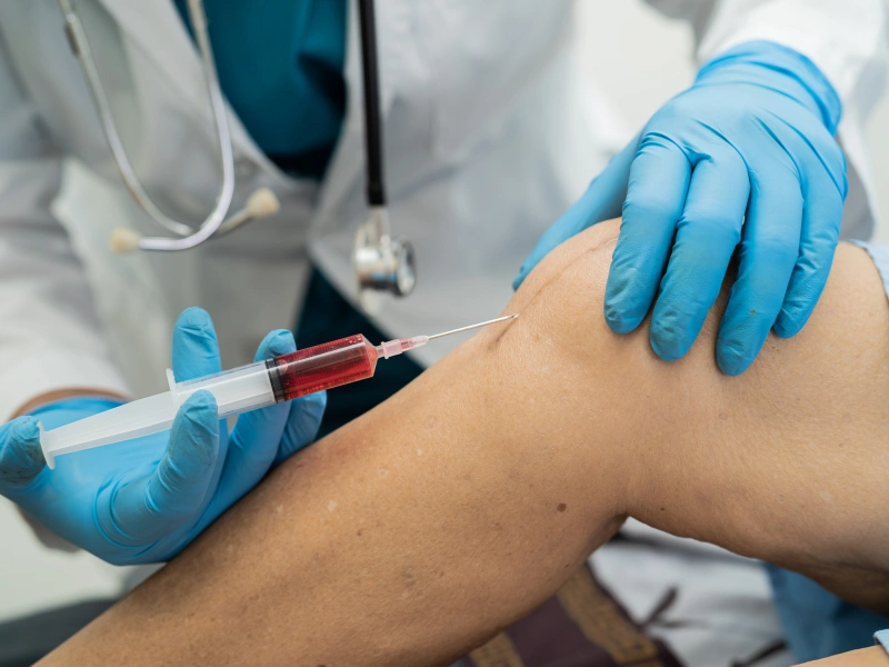 prp injections cost
