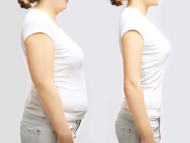 semaglutide shots before and after