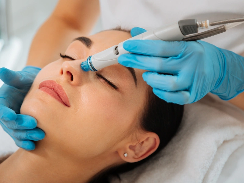 what is hydrafacial eye perk