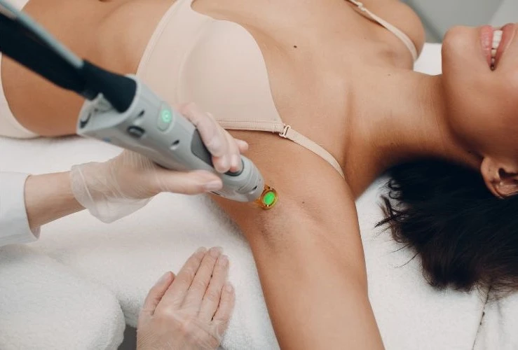 what is laser hair removal
