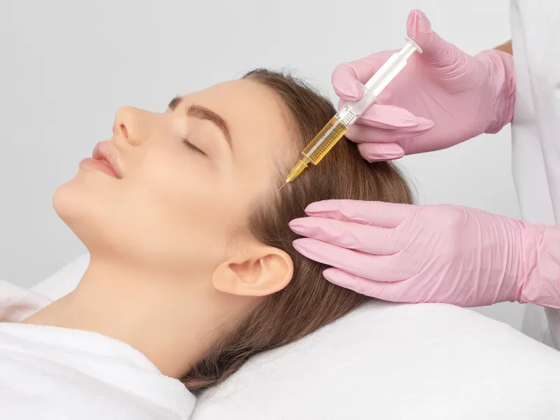 what is prp microneedling for hair