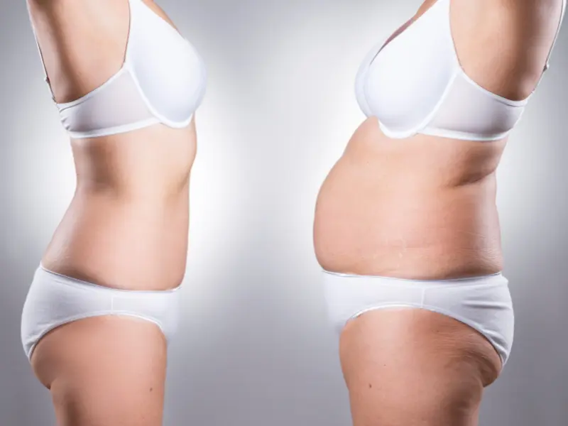 body contouring before and after